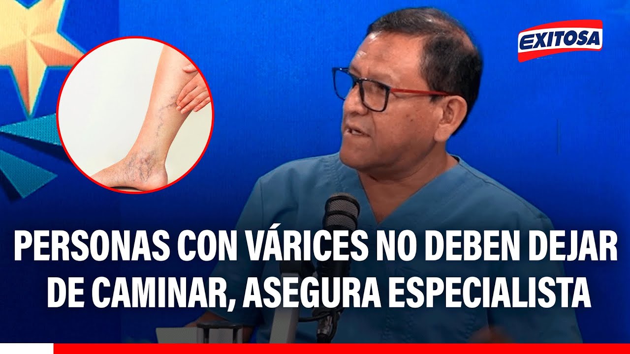 🔴🔵Personas con várices no deben dejar de caminar, asegura especialista