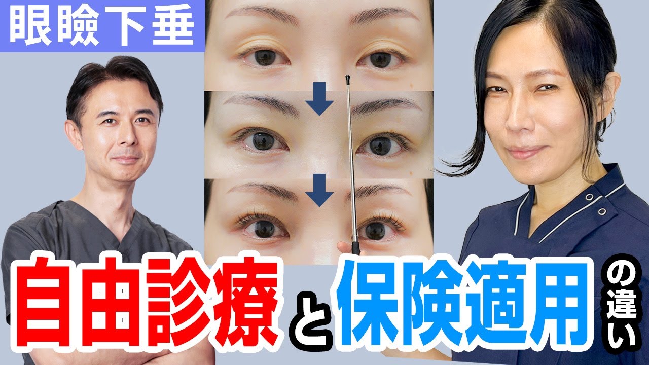 【眼瞼下垂】保険適用と自由診療の違いを徹底比較