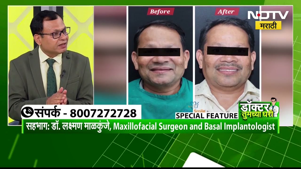डॉक्टर तुमच्या घरी | विषय: कॉर्टिको-बेसल इम्प्लांट्स: फक्त 72 तास, नवे दात नवा आत्मविश्वास!