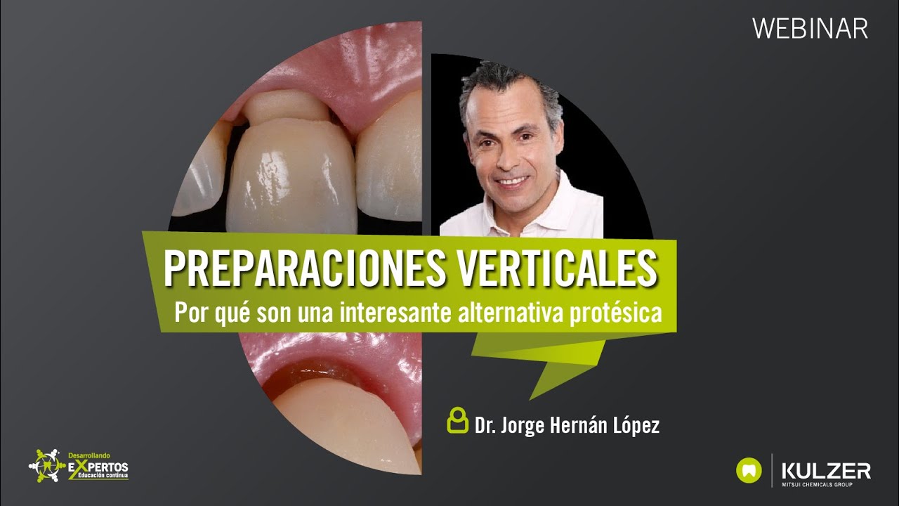 PREPARACIONES VERTICALES   Por qué son una interesante alternativa protésica
