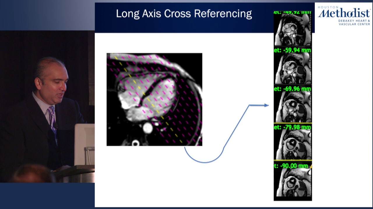 Advantages of CMR Imaging