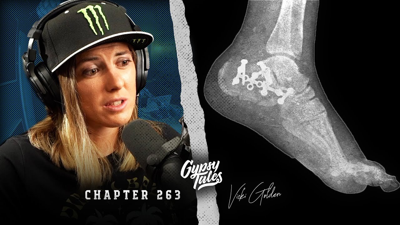 HOW TO LOSE YOUR LEG ON A DIRTBIKE!  - Vicki Golden is lucky to still be riding...