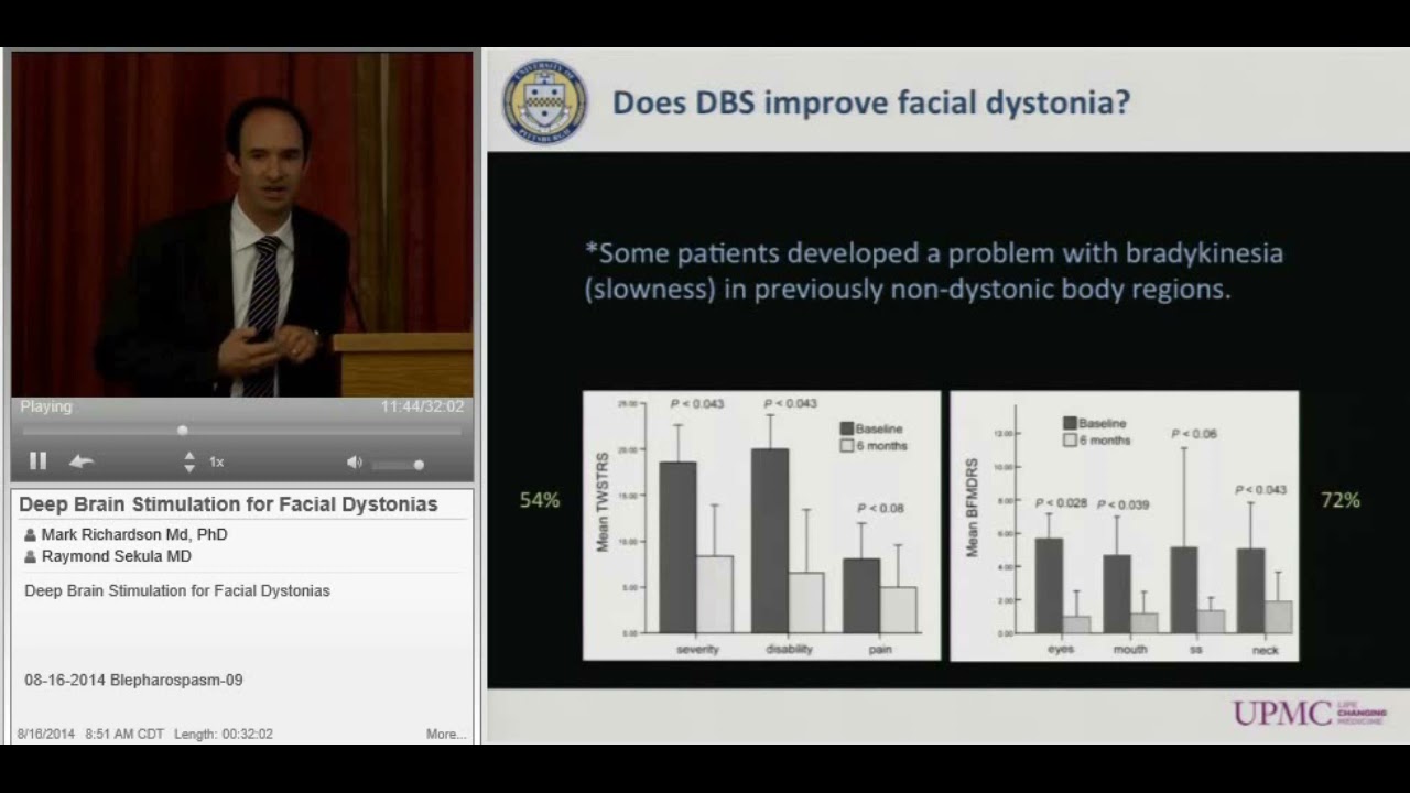 Deep Brain Stimulation for Facial Dystonias
