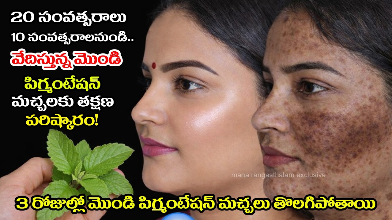 3 రోజుల్లో పిగ్మెంటేషన్ తగ్గుతుందా? నిజమా?🤔 10 ఏళ్ల డార్క్ స్పాట్స్‌కు షాకింగ్ సీక్రెట్ రెమెడీ ఇదే 😱