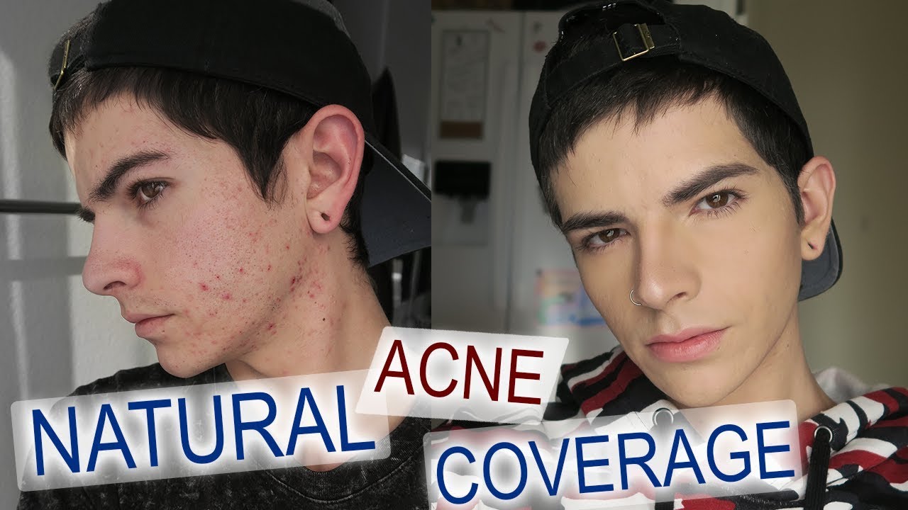 Drugstore Acne Coverage Foundation Routine | NON-CAKEY Natural for Men and Women | Kevin Rupard
