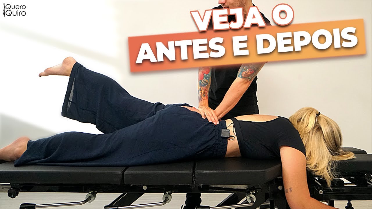 DORES INTENSAS NA REGIÃO LOMBAR COM APENAS 18 ANOS