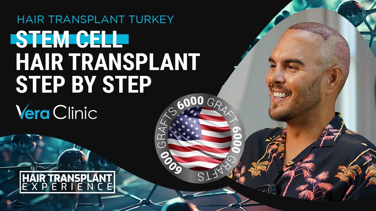Stem Cell Hair Transplant Turkey #hairtransplant #hairtransplantturkey #stemcellhairtransplant