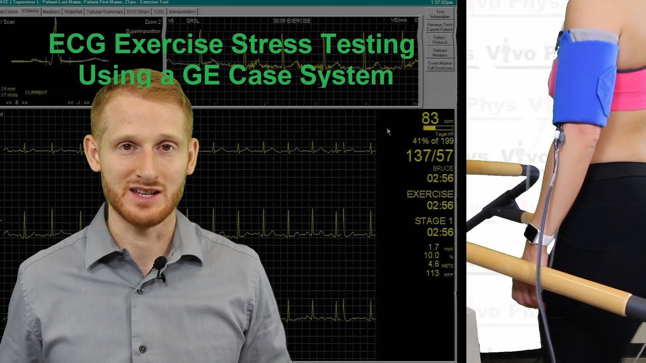 ECG Exercise Stress Testing Using a GE Case System