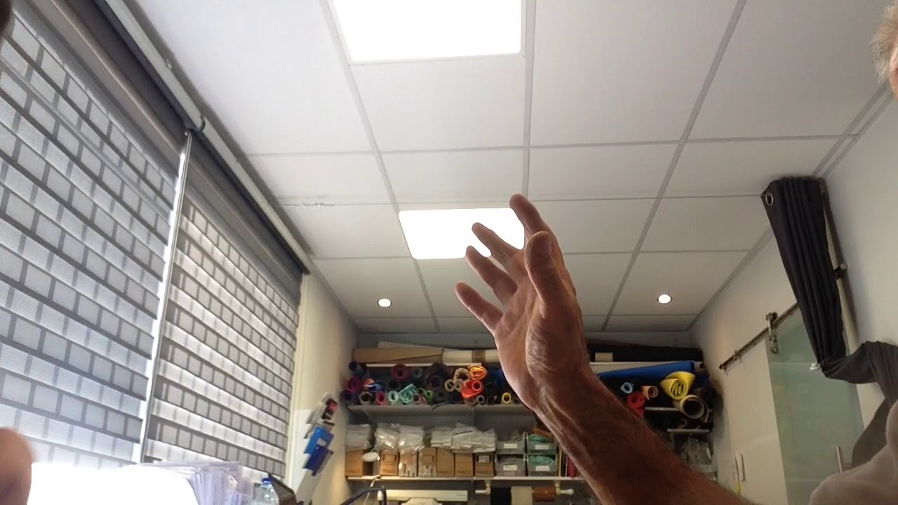 Moulage d'une Orthése poignet pouce sur mesure