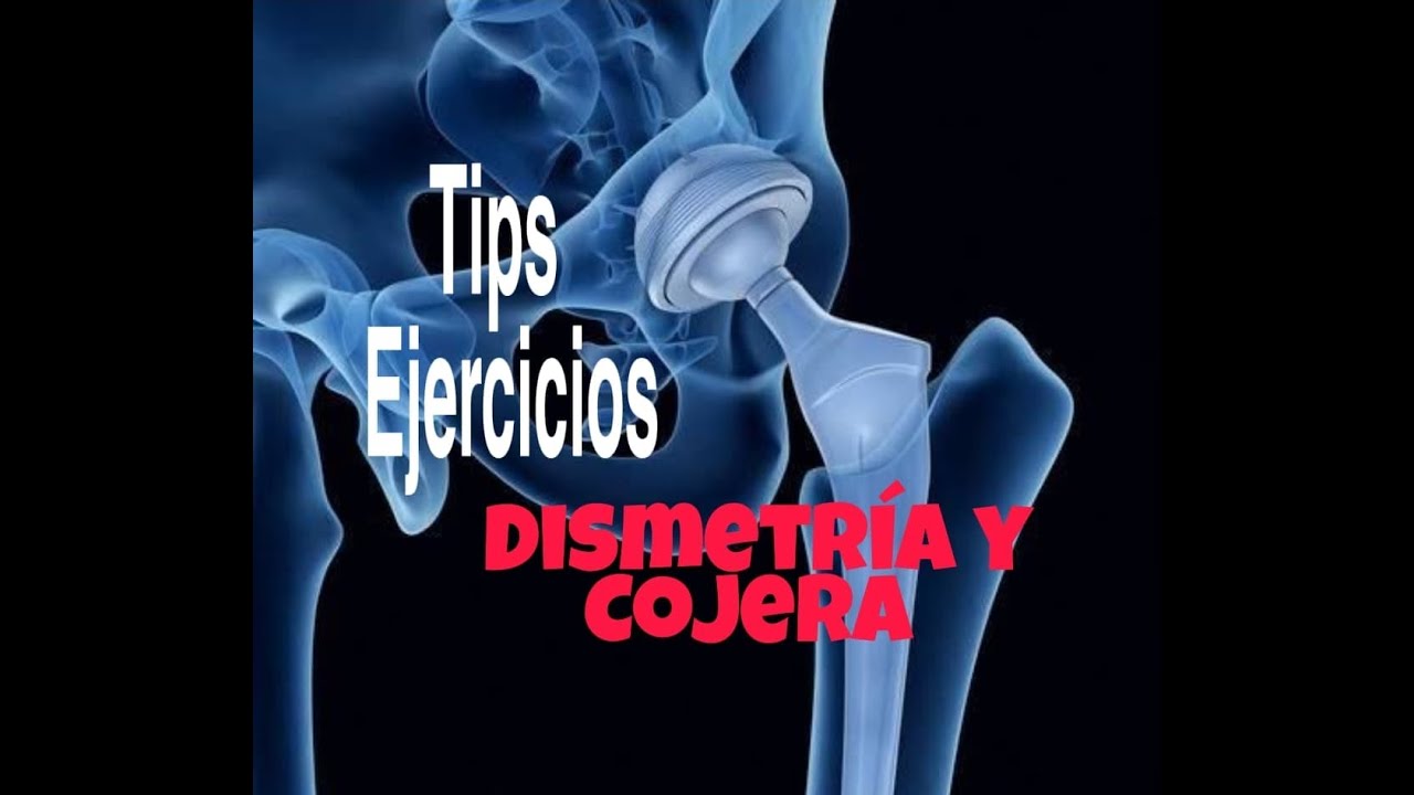 Tips y ejercicios Dismetria y Cojera
