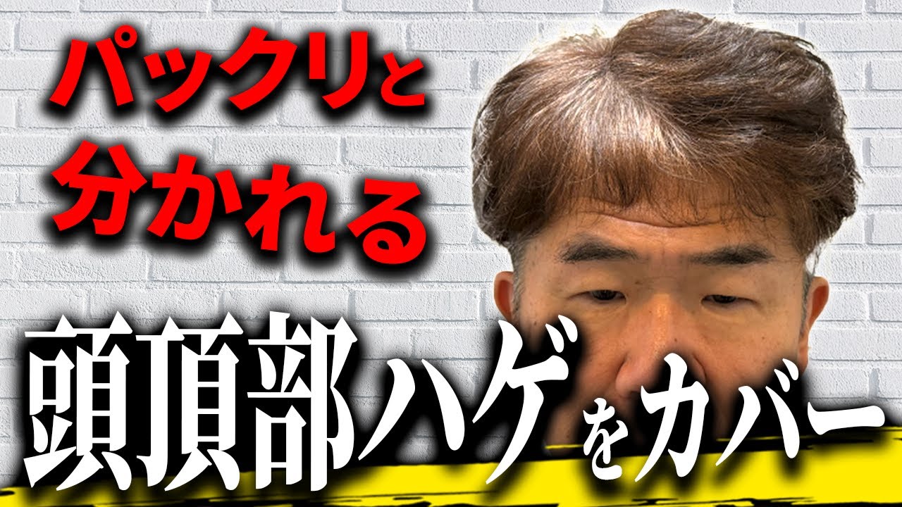 【頭頂部ハゲ】美容室カットでバランスの悪さが気になるモデルさん。薄毛をカバーしてオシャレヘアに大変身！
