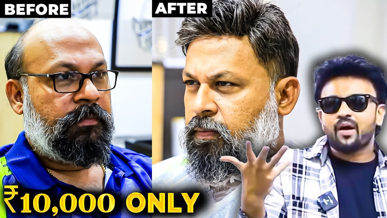 Hair Loss தலையா இப்படி Style தலையா மாத்த முடியுமா? Go Back to your Golden Days in ₹10,000