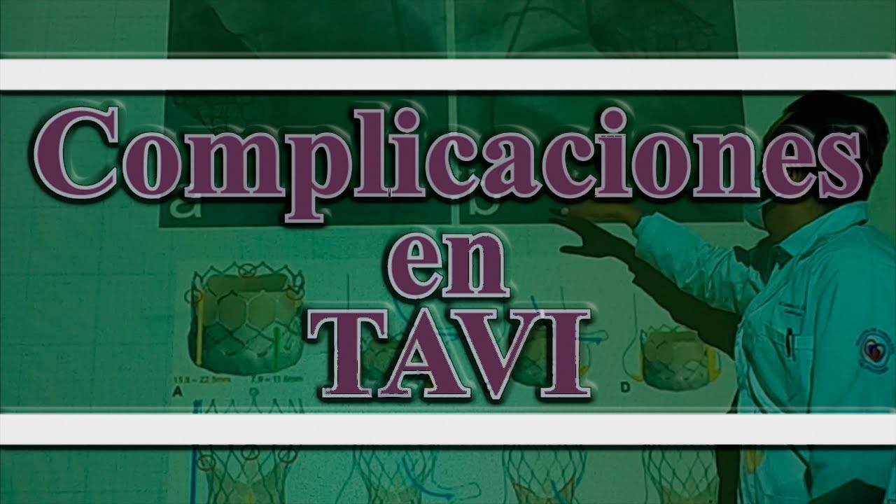 Complicaciones en TAVI