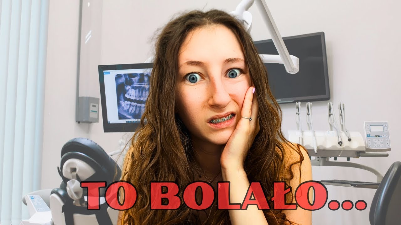 VLOG | NAJGORSZA WIZYTA U DENTYSTY !?