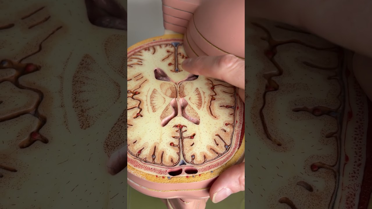 The thalamus is a sensory filter in the brain #anatomy
