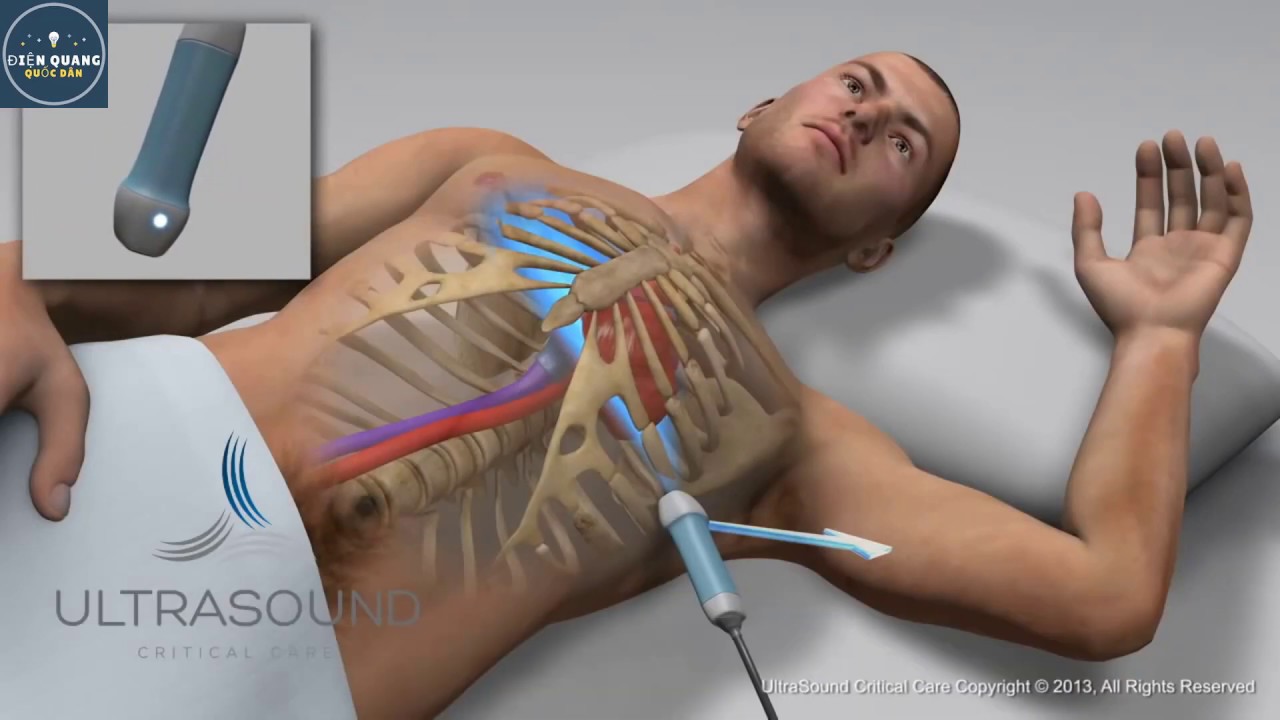 Các Mặt Cắt Siêu Âm Tim Cơ Bản - Hình 3D Rất Dễ Hiểu