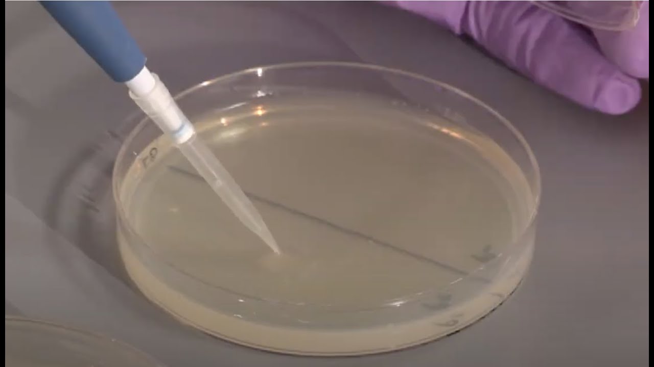 Plating Bacteria