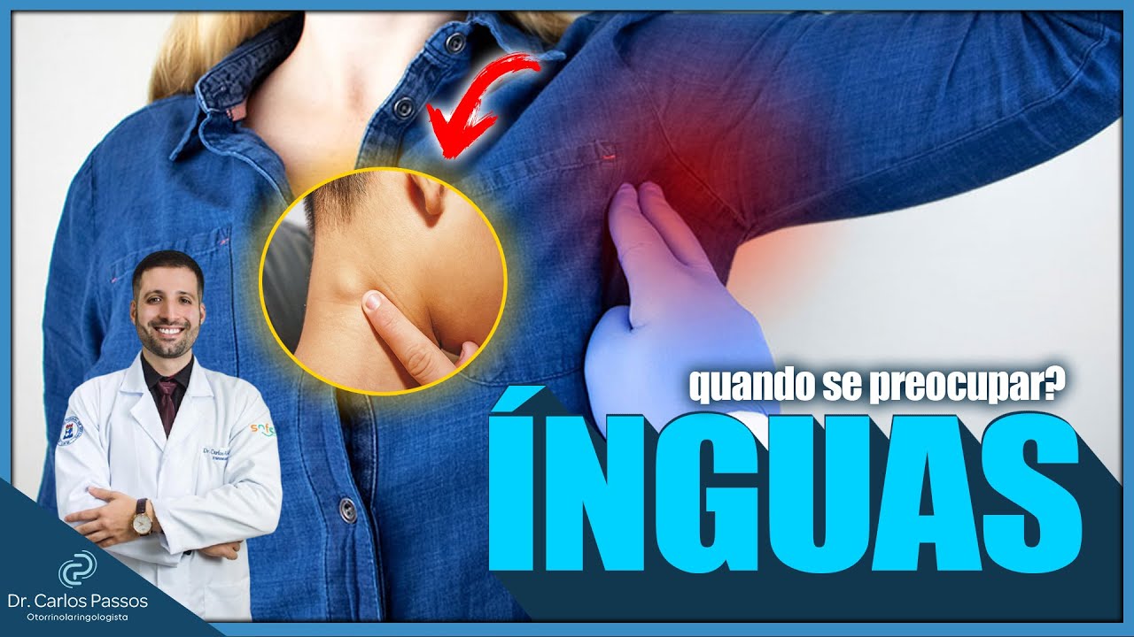 ÍNGUA NO PESCOÇO, O QUE PODE SER? QUANDO SE PREOCUPAR?