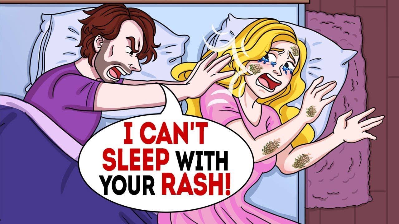 Husband forced me to sleep on the floor 'cuz of my rash