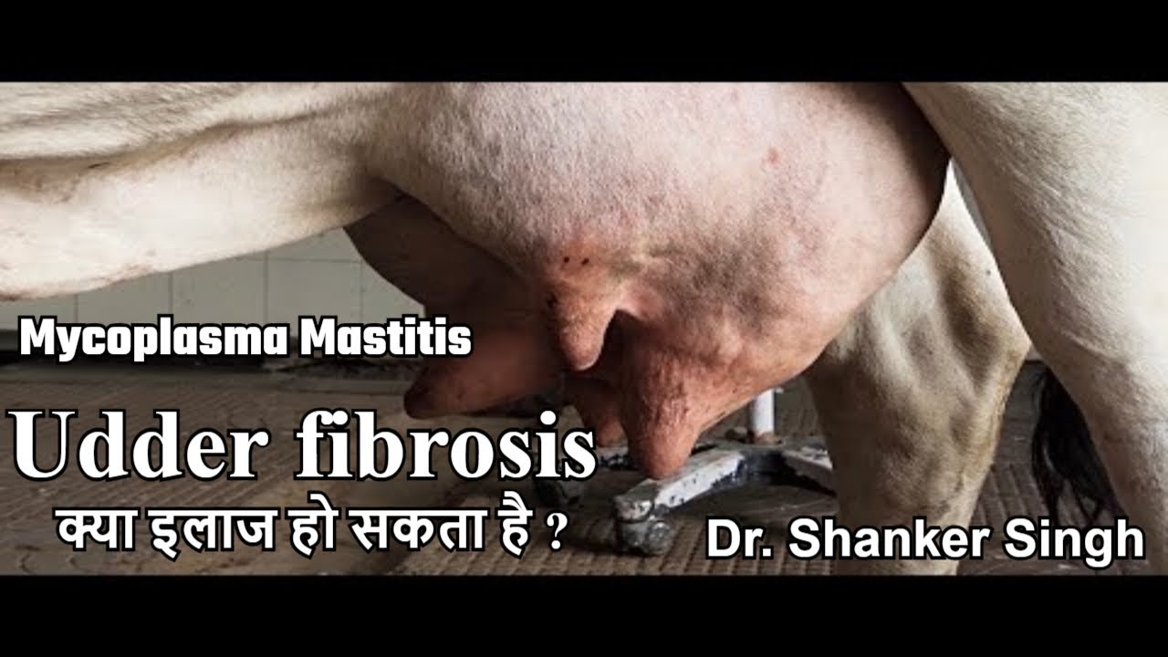 Udder Fibrosis ! Mastitis ! एक दिन में थन पत्थर की तरह हो गया ! क्या है उपचार?