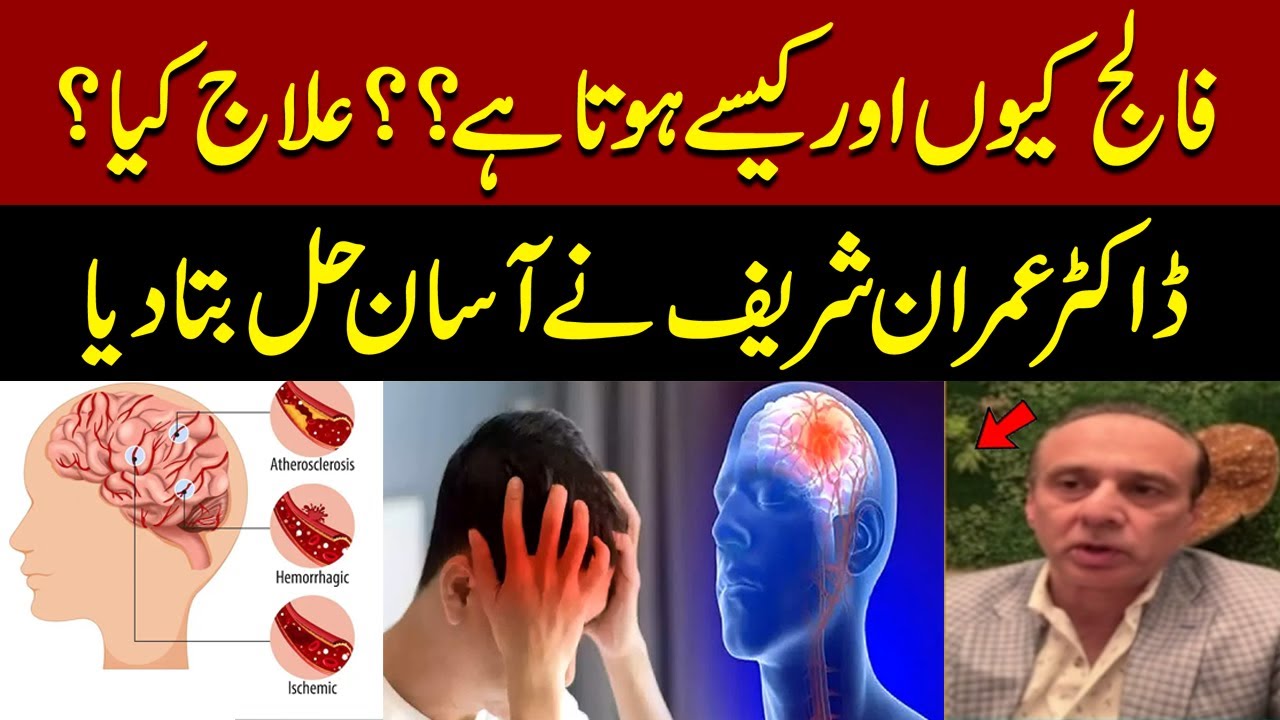 Why Stroke Happens & How to Treat It | Dr. Imran Sharif Explains Simple Cure  | Pakistan News