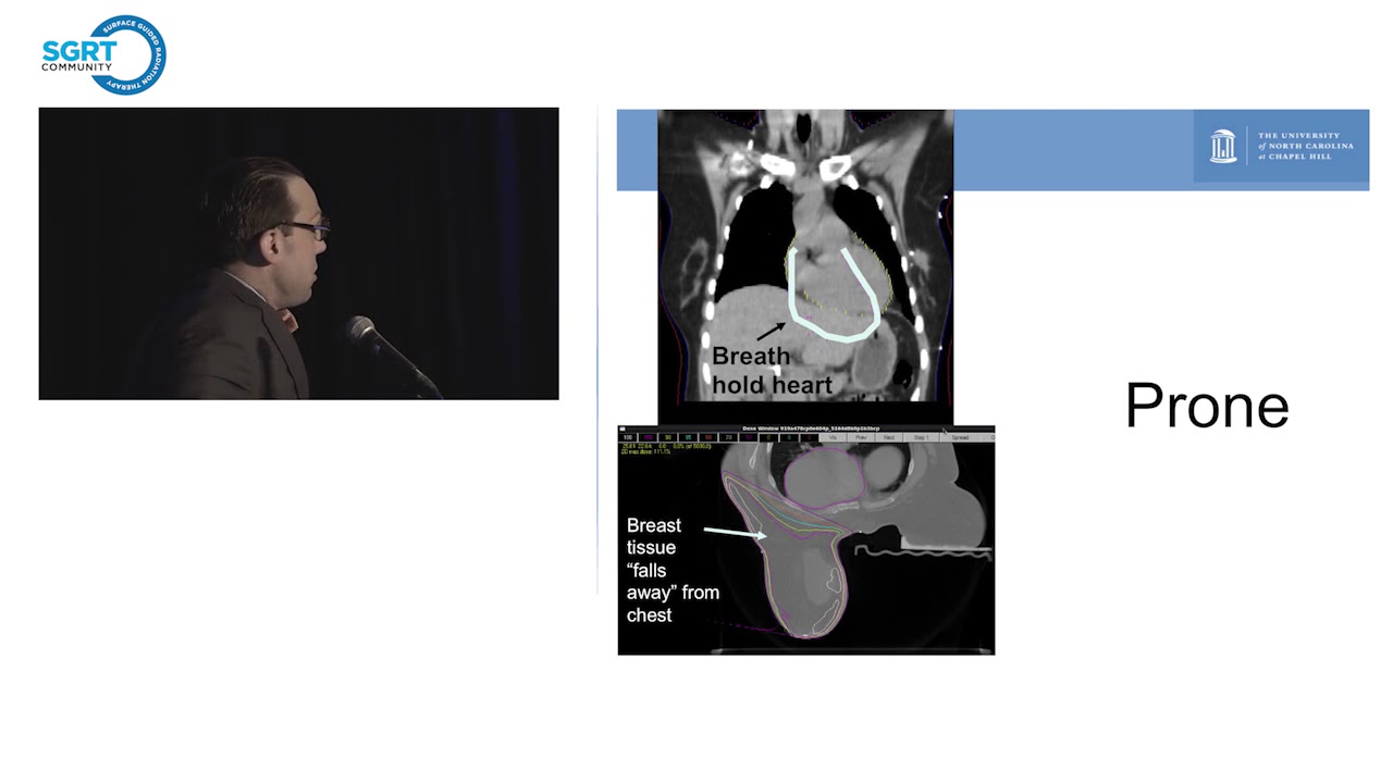 SGRT for Left Sided Breast Cancer: the evidence