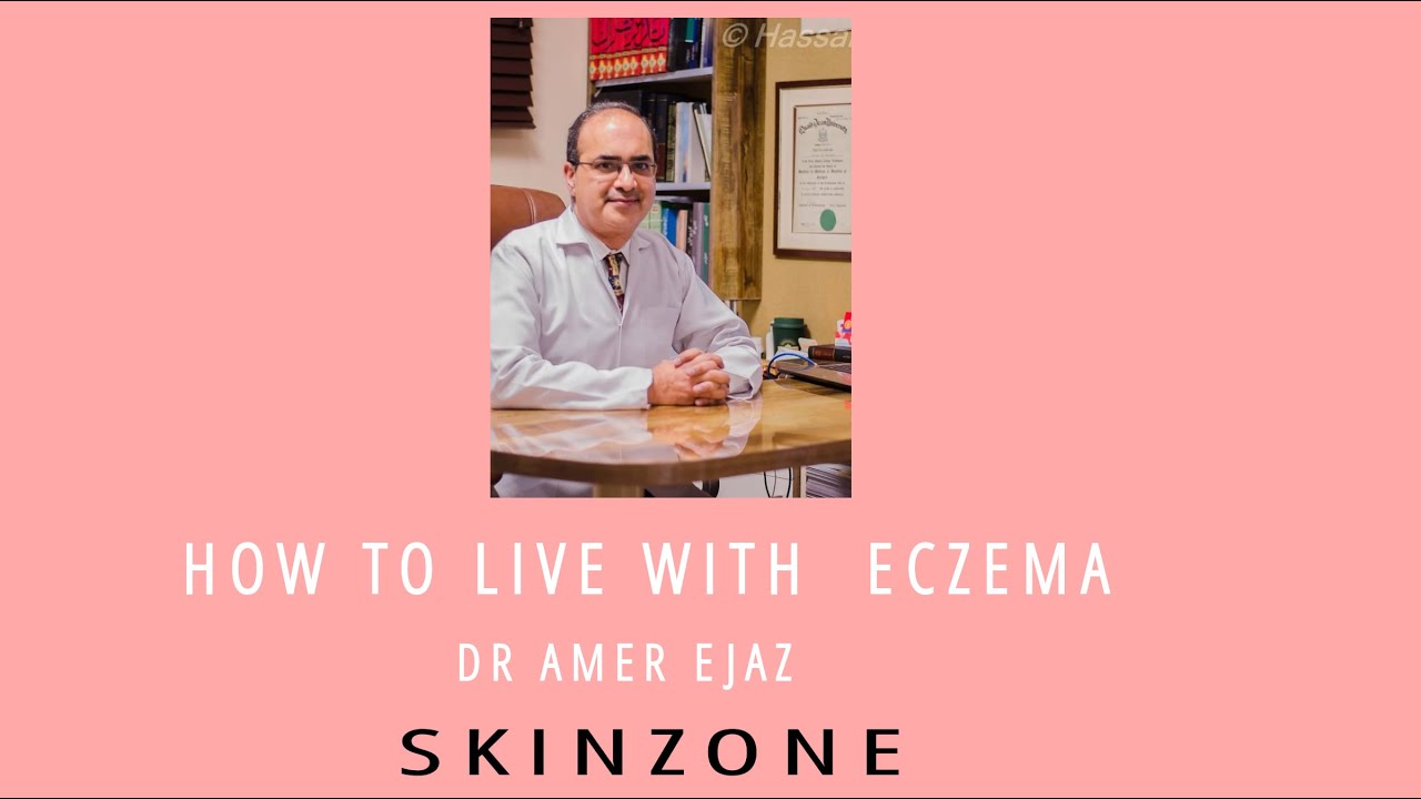 HOW TO LIVE WITH ECZEMA