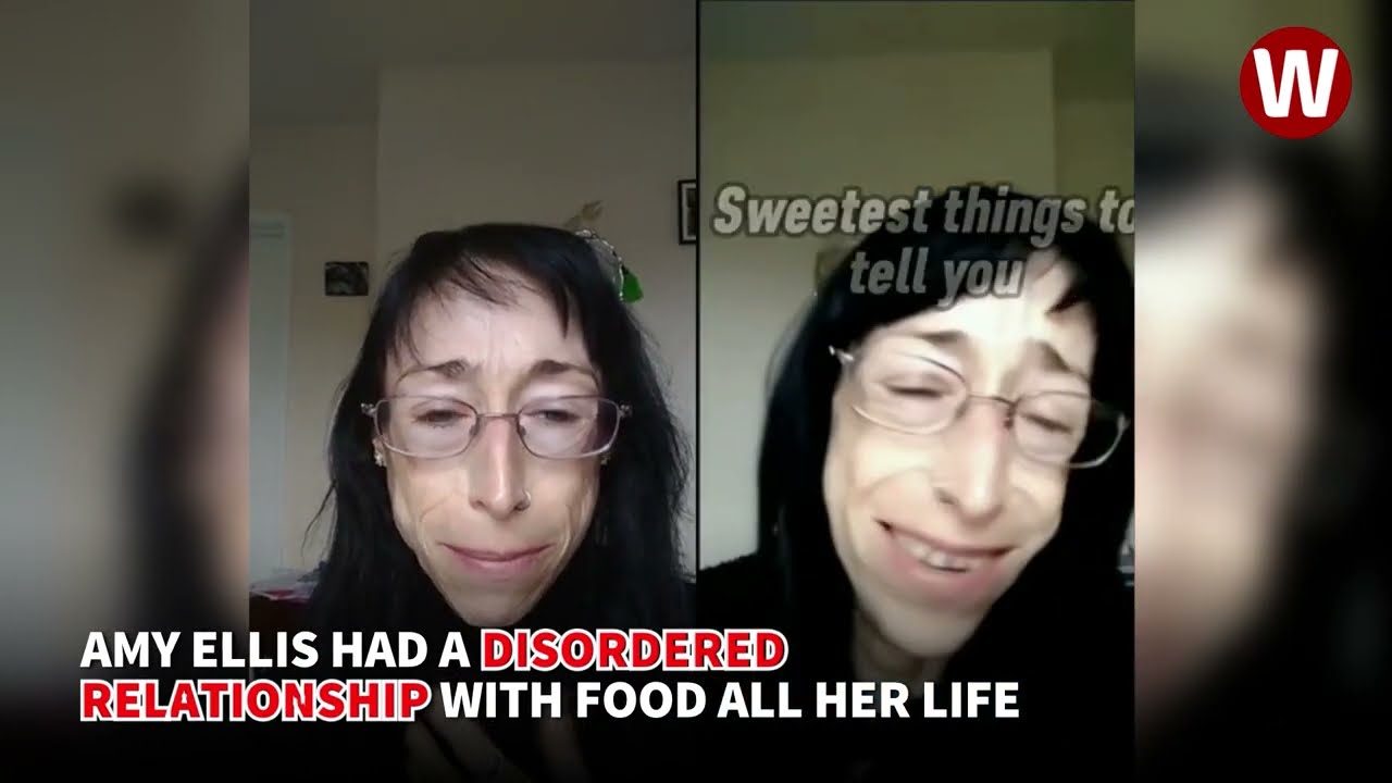 Amy Ellis who documented struggle with anorexia dies