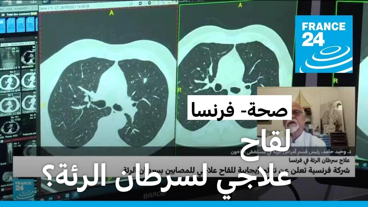 لقاح فرنسي لمرضى سرطان الرئة يحقق نتائج إيجابية خلال الاختبارات السريرية