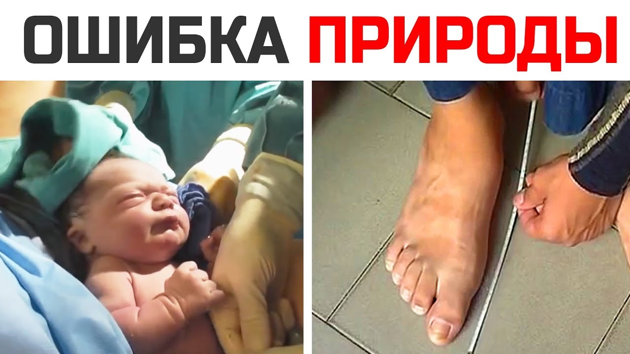 Мальчик случайно превратился в гиганта. Невероятная история необычного человека