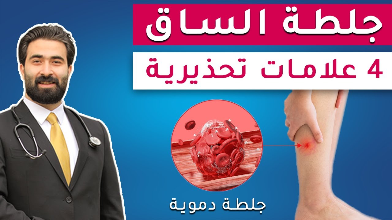 انتبه ! 4 علامات تحذيرية تدل على وجود جلطة في الساق | اسباب جلطة الاوردة العميقة وكيف تحمي نفسك