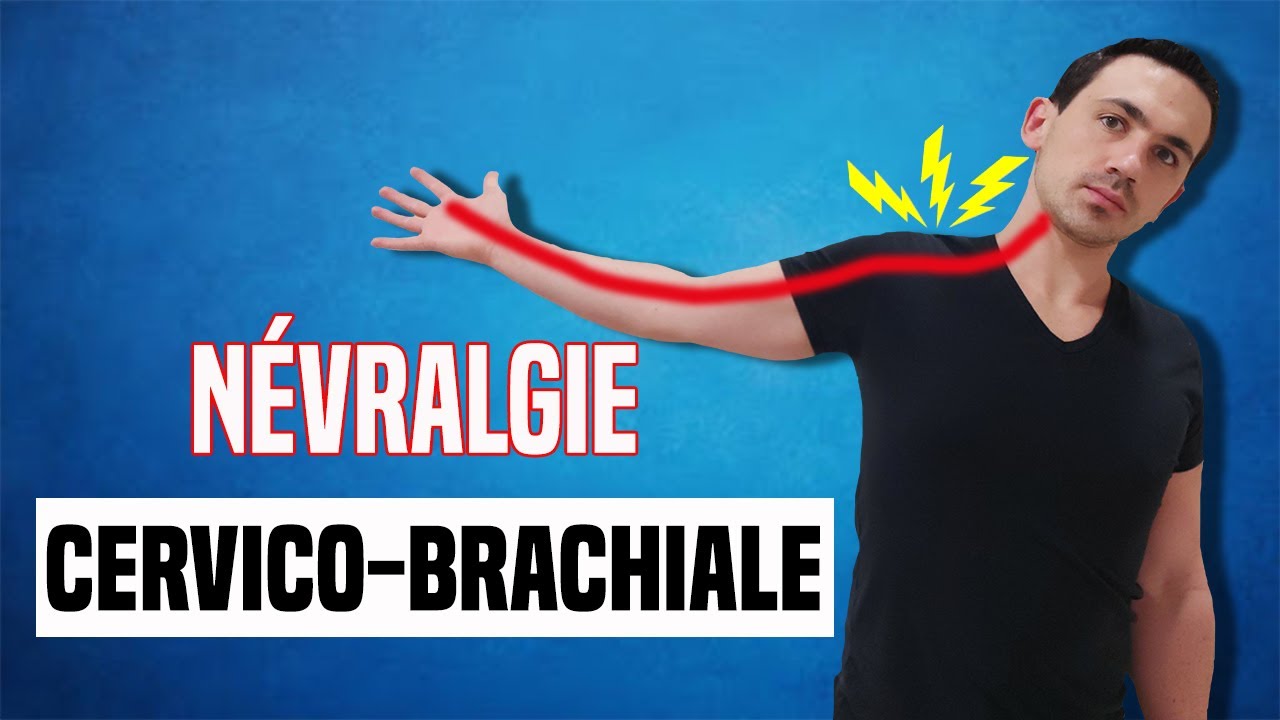 TRAITEMENT DE LA NÉVRALGIE CERVICO BRACHIAL :  EXERCICE KINÉ