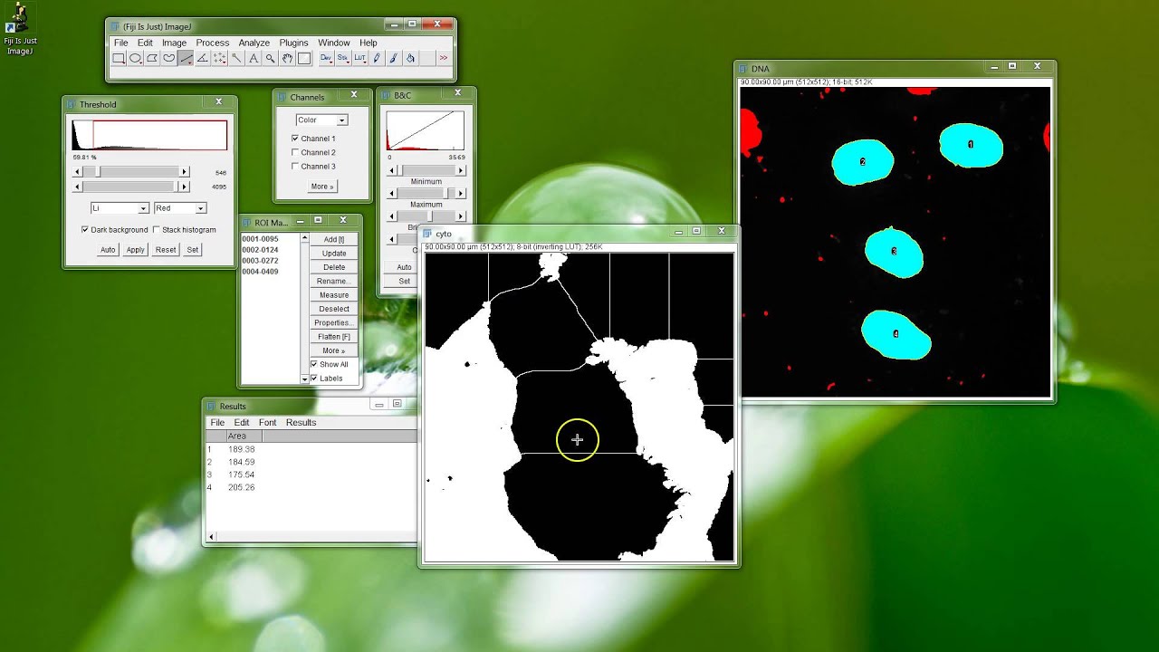 Fiji Is Just ImageJ - Counting Cells, Part 2 - Cytoplasm