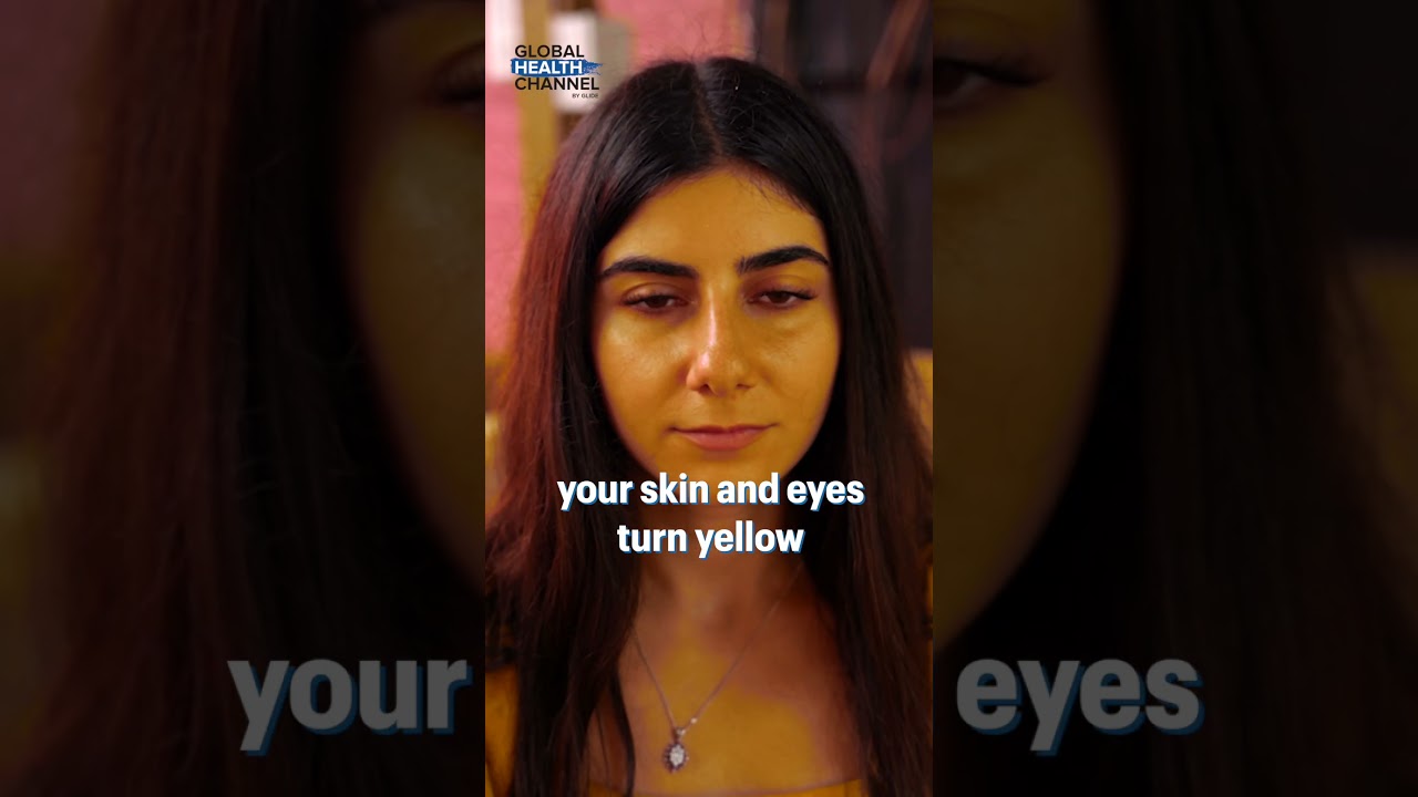 7 signs of Yellow Fever!