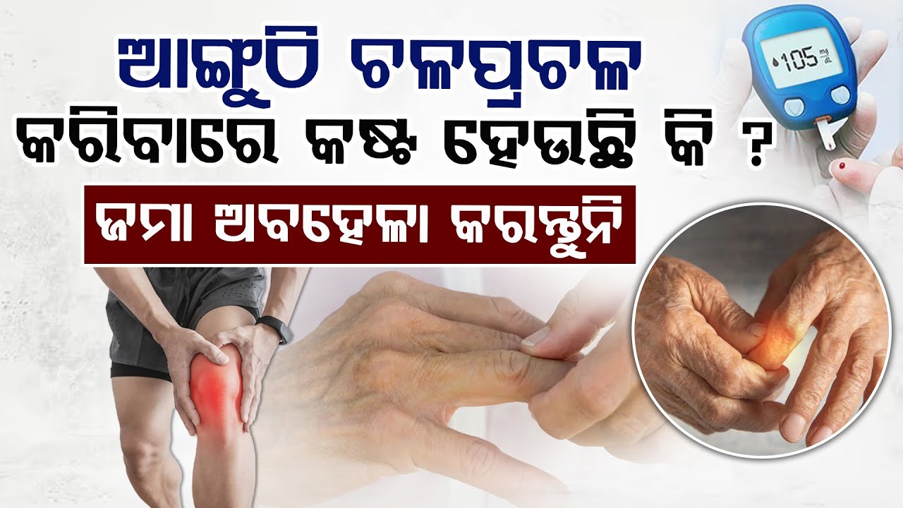 Diabetic cheiroarthropathy: Not Arthritis, But a Hidden Diabetes Warning Sign