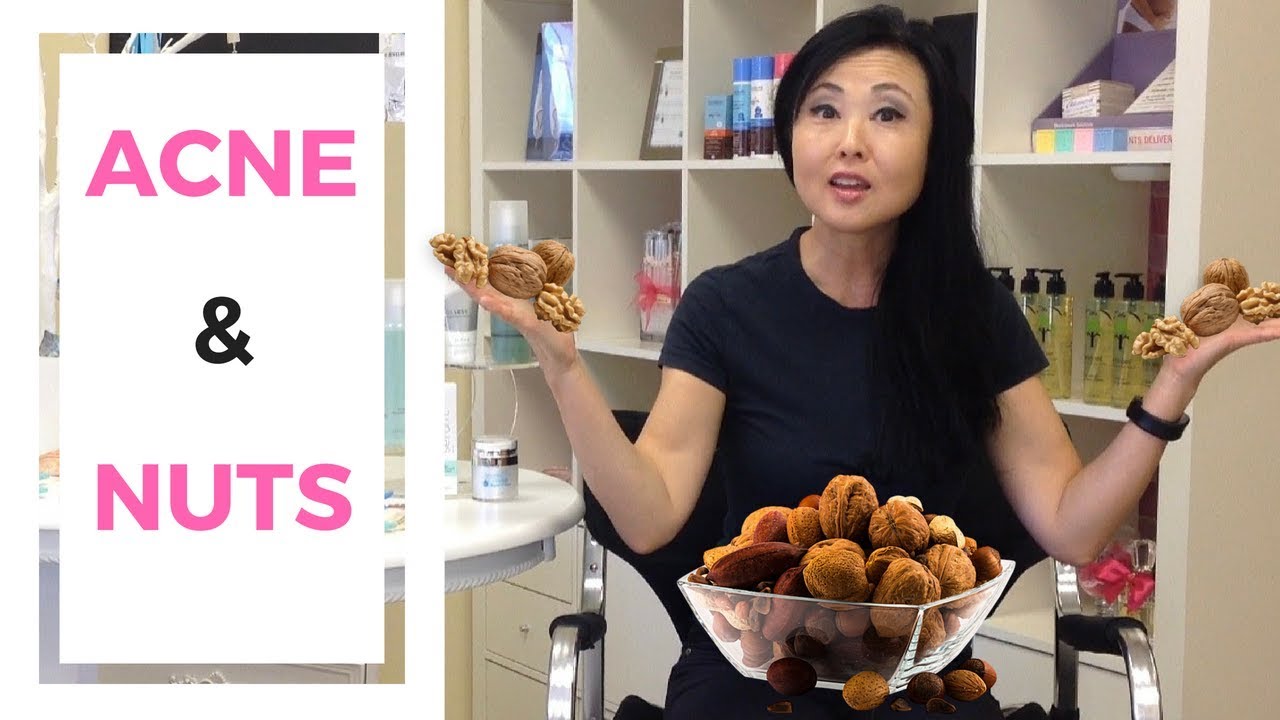 ACNE AND NUTS