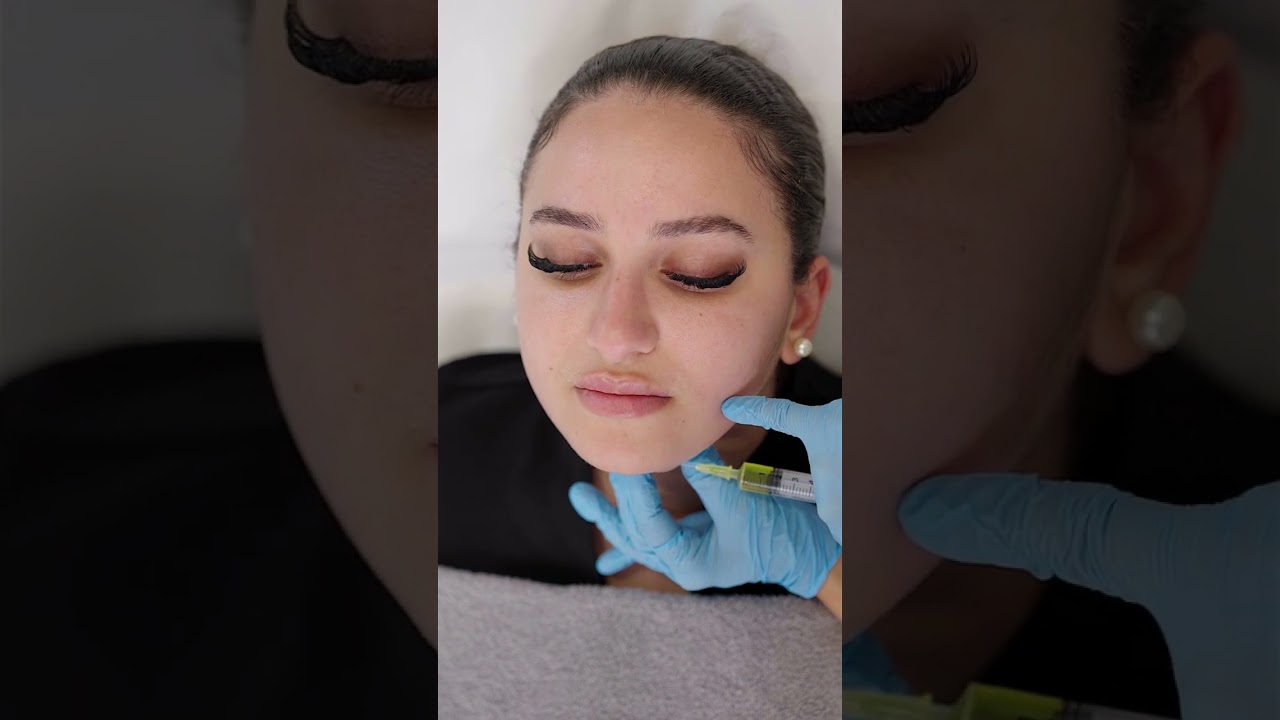 Sculpt Your Way to a Defined Jawline: Lemon Bottle Fat Dissolving Injection at Este Medical