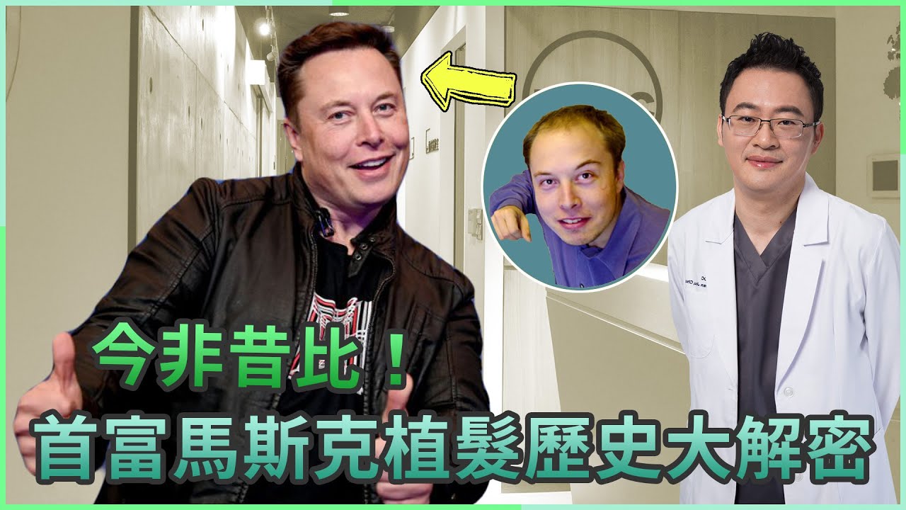 首富馬斯克植髮歷史大解密｜生髮植髮專家朱冠州院長