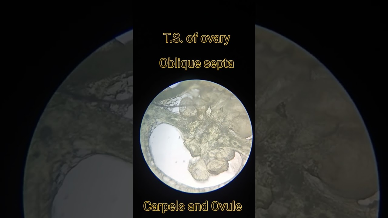 T.S. of Capsicum ovary, oblique septa, carpels, Ovule , #shorts #short