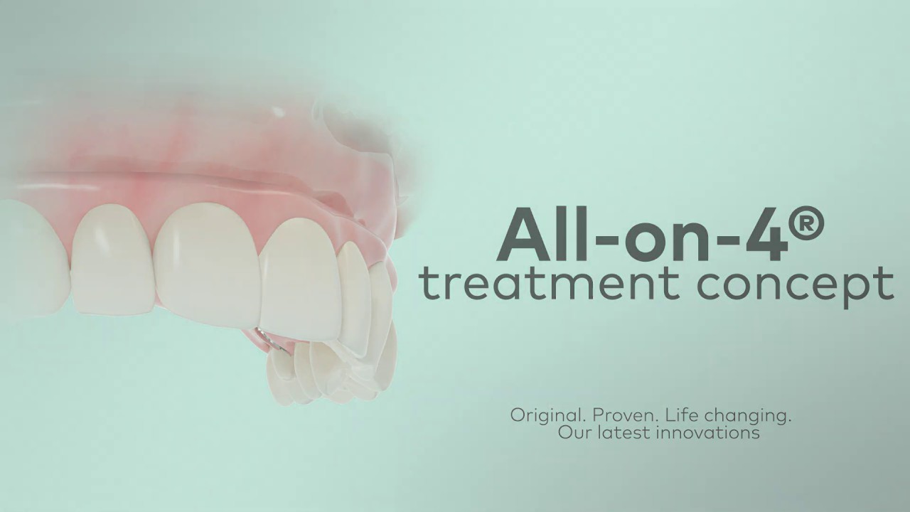 All-on-4® treatment concept – A minimally invasive solution with a fixed full-arch restoration