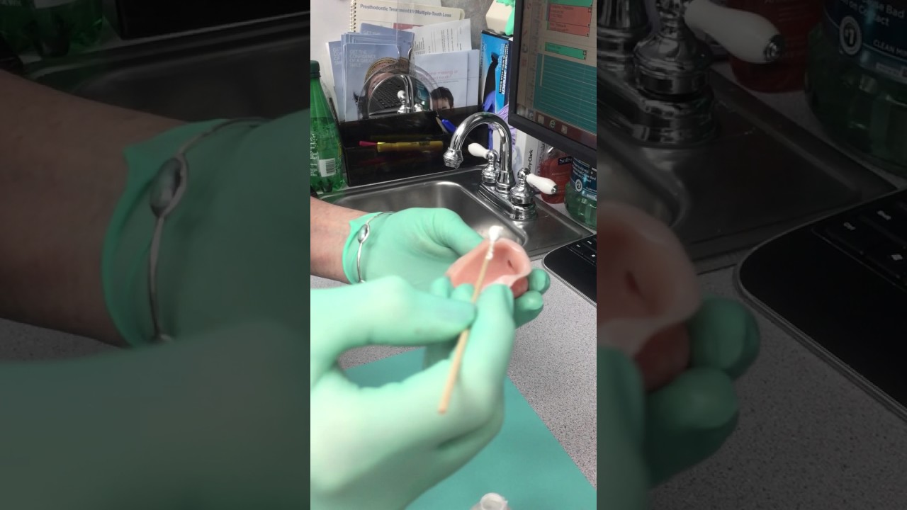 Prosthetic Nose - Cancer prosthesis - cleaning and adhesive placement