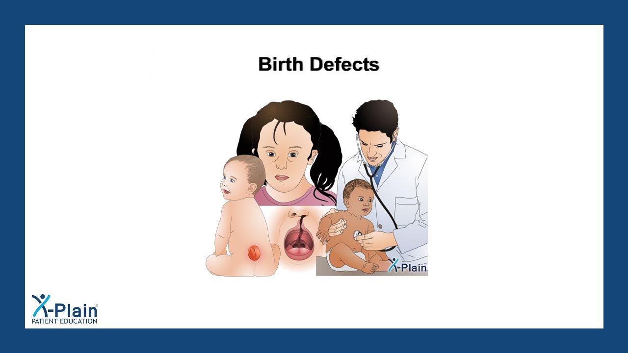 Birth Defects