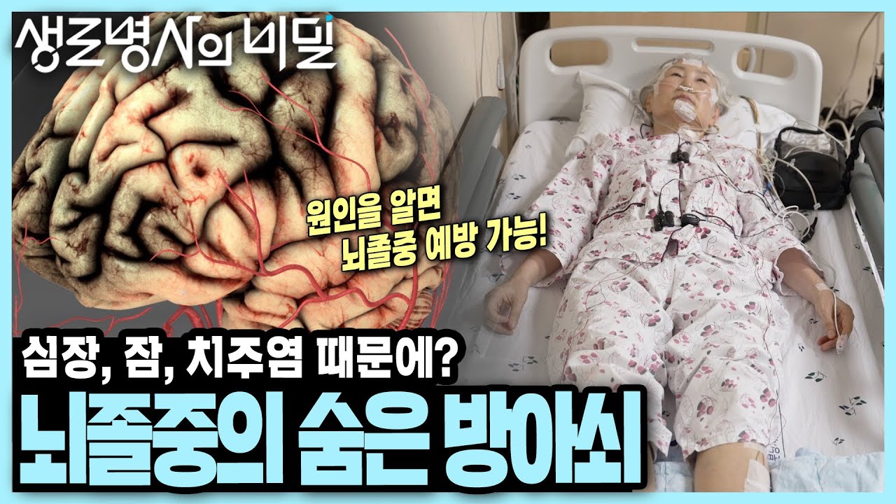 [본방 종합] 나이, 성별, 증상에 상관없이 뇌졸중의 방아쇠가 되는 질환들! 심장, 잠, 치주염 I 생로병사의 비밀 KBS 250924  방송