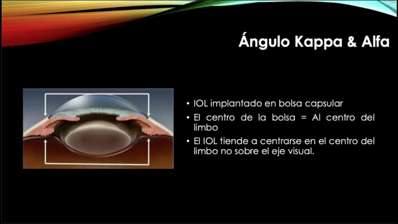 Aberrometria por iTrace - Dr. Angel Costa