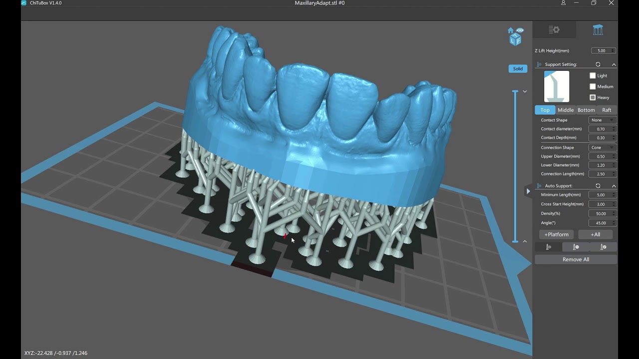 Orientating Dental Models for Printing