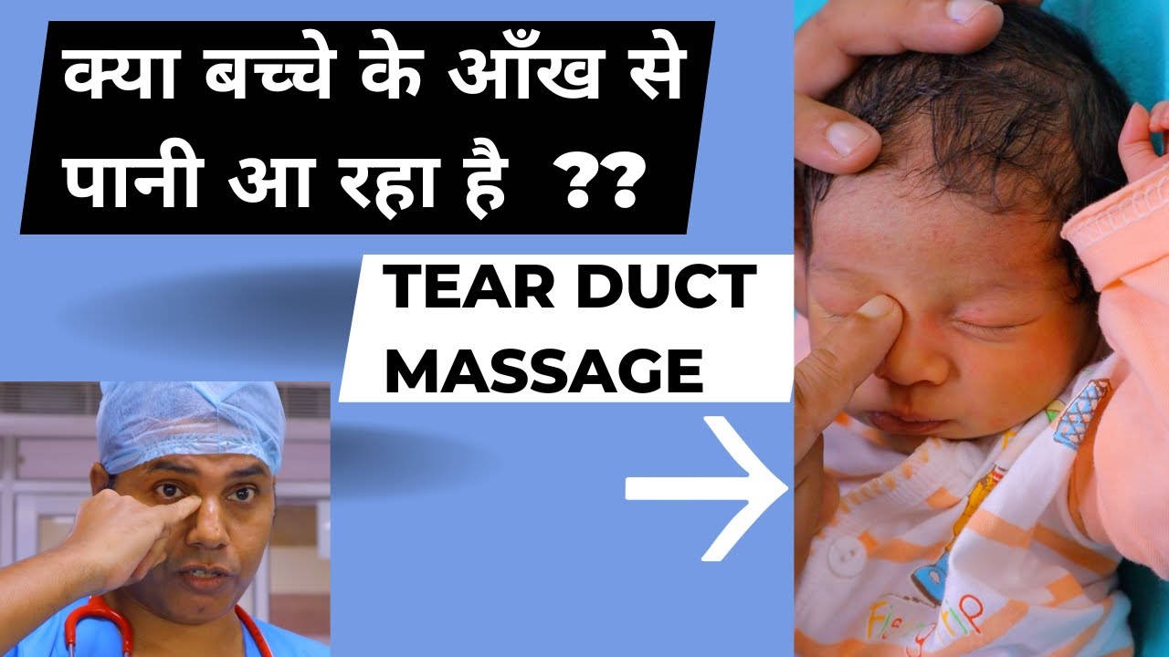 क्या आपके बच्चे की आँखों से पानी आ रहा है? | Sticky eyes | Lacrymal Duct massage