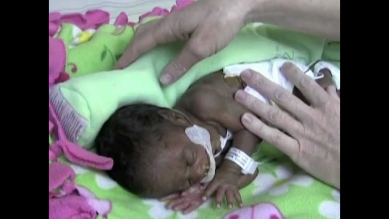 Right Sidelying Position /  Positioning NICU patients with The Zaky / Instructional Video