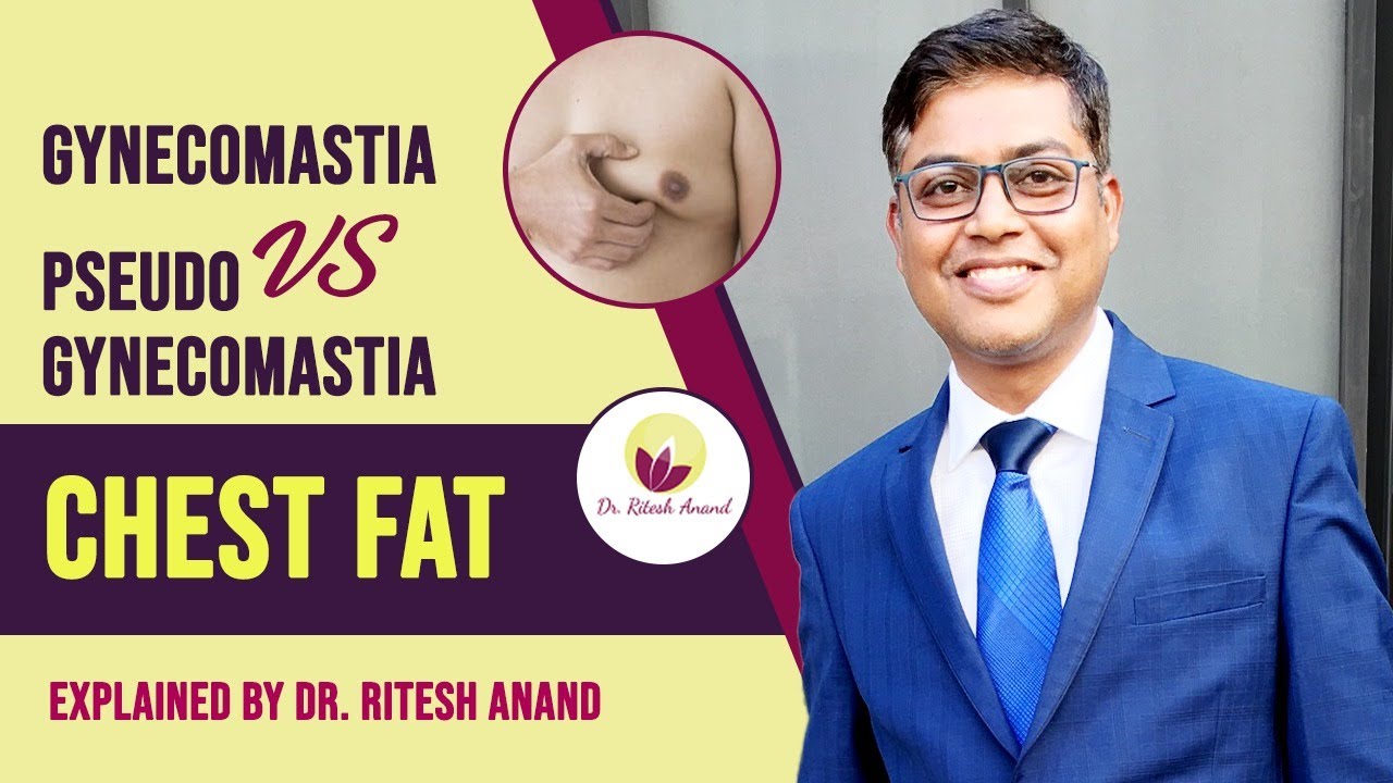 How To know If You Have Gynecomastia Or Pseudo-Gynecomastia?| Pseudo Gynecomastia v/s Gynecomastia