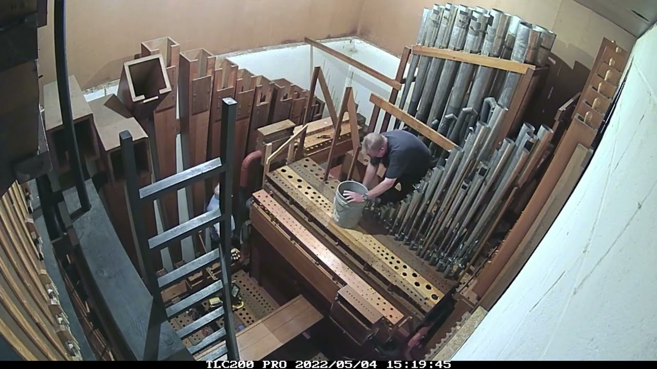 Organ Removal Timelapse