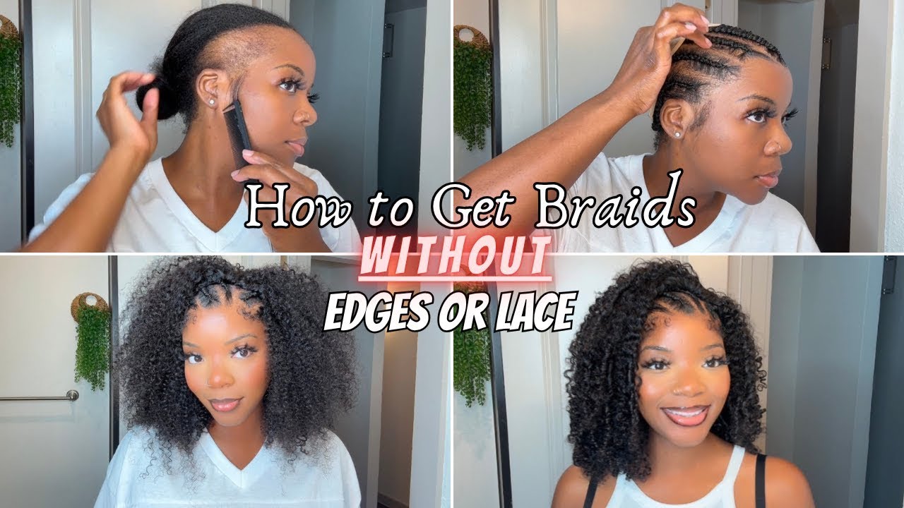 No edges, how to get half braids, half wig style alopecia alopecia-friendly